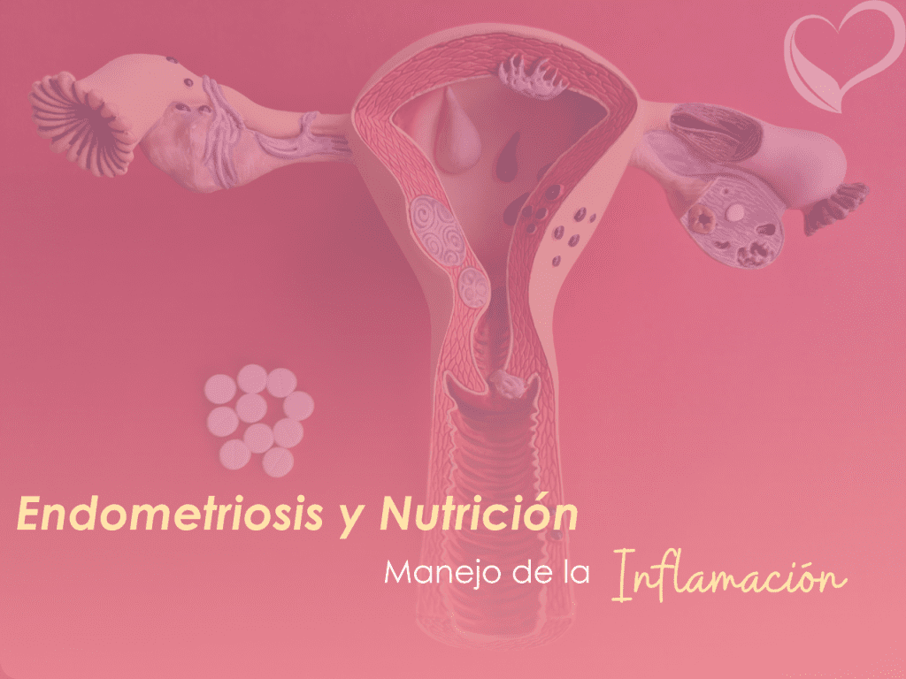 Gráfico ilustrando alimentos antiinflamatorios para la endometriosis, con el texto 'Endometriosis y Nutrición: Manejo de la Inflamación'.