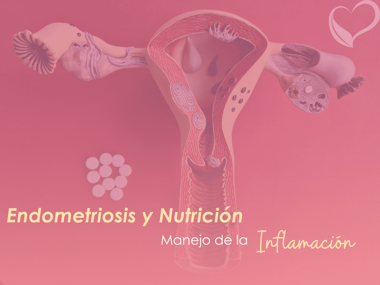 Estrategias y alimentos antiinflamatorios para endometriosis – Ana María Vilas